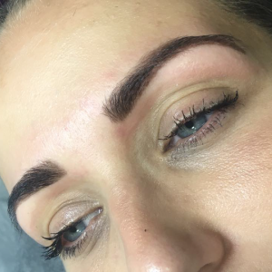 eyebrow treatment